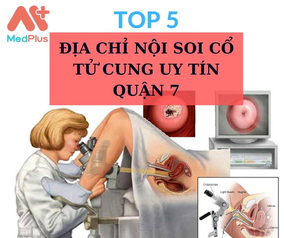 Tổng hợp 5 địa chỉ nội soi cổ tử cung uy tín quận 7 134 Nội soi cổ tử cung quận 7