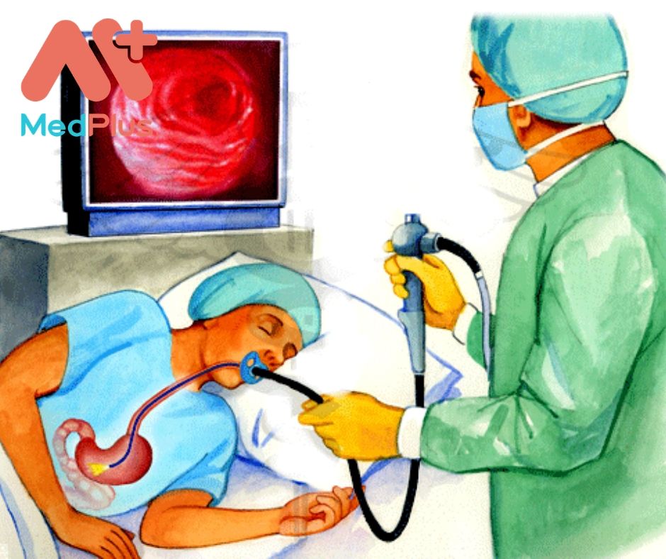 Nội soi dạ dày huyện Củ Chi