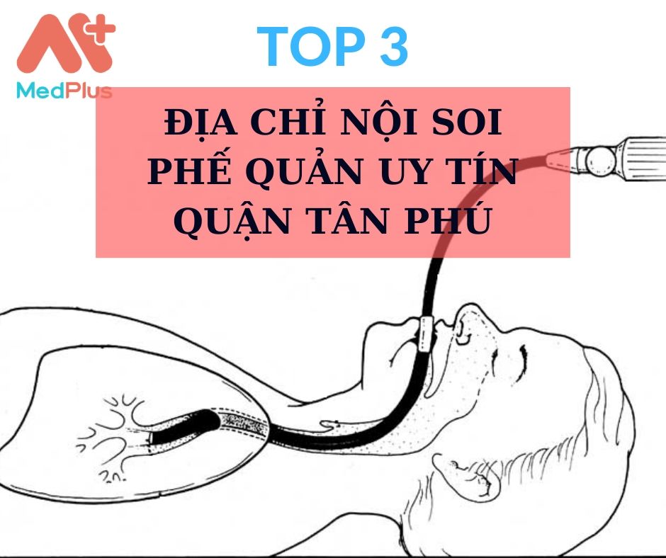 Top 3 địa chỉ nội soi phế quản uy tín quận Tân Phú 127 Nội soi phế quản quận Tân Phú
