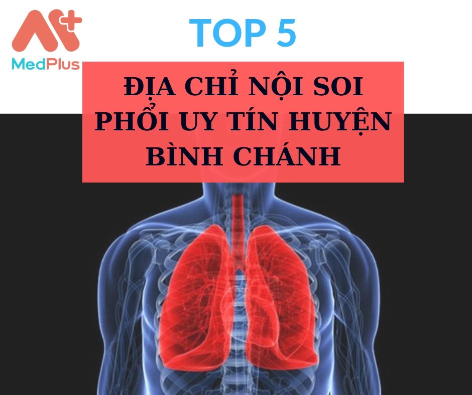 Top 5 địa chỉ nội soi phổi uy tín huyện Bình Chánh 130 Nội soi phổi huyện Bình Chánh