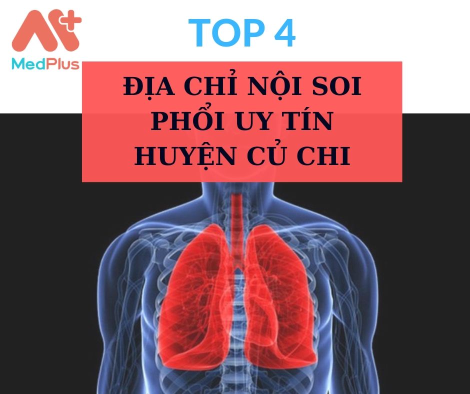 Top 4 địa chỉ nội soi phổi uy tín huyện Củ Chi 132 Nội soi phổi huyện Củ Chi
