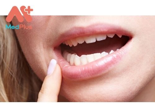 Điểm qua địa chỉ khám Ung thư miệng uy tín Quận 1