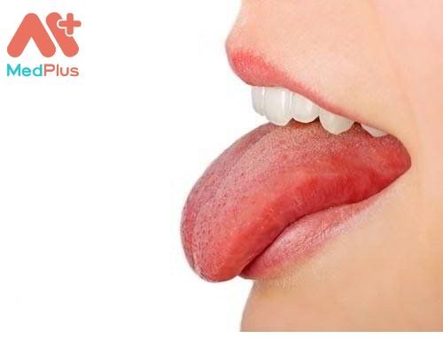 Tìm hiểu địa chỉ khám Ung thư lưỡi uy tín Huyện Củ Chi