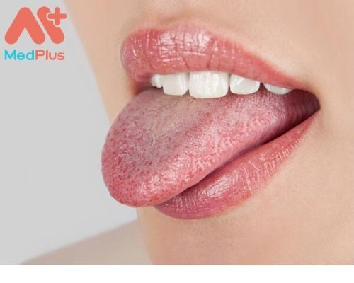 Tìm hiểu địa chỉ khám Ung thư lưỡi uy tín Huyện Củ Chi