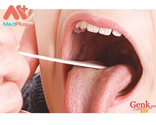 Điểm qua địa chỉ khám Ung thư miệng uy tín Quận 1