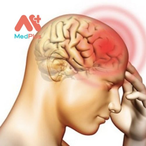 Những nơi khám chấn thương sọ não uy tín Quận Thủ Đức