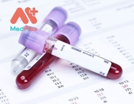 Tìm hiểu 5 địa chỉ khám huyết học hàng đầu Thủ Đức 131 khám huyết học hàng đầu Thủ Đức