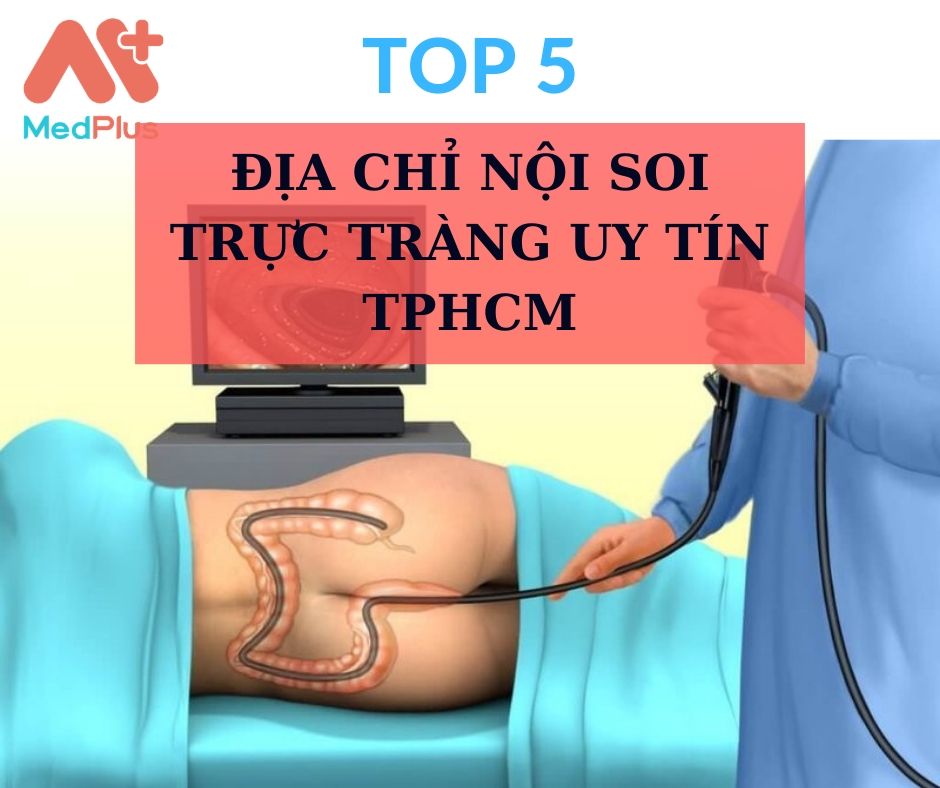 Nội soi trực tràng TPHCM