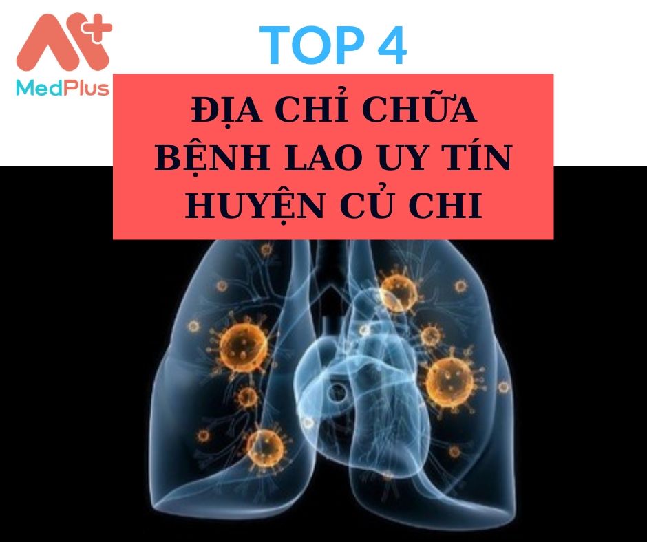 Địa chỉ chữa bệnh lao huyện Củ Chi