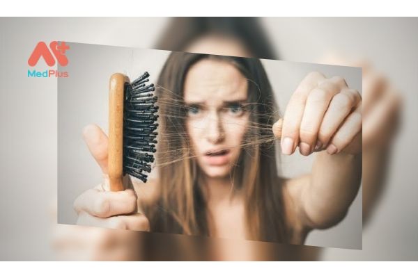 Bạn lo lắng khi tóc rụng quá nhiều?