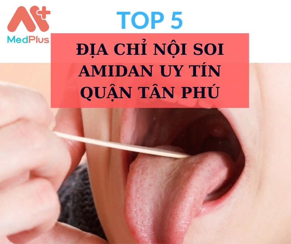 Nội soi amidan quận Tân Phú
