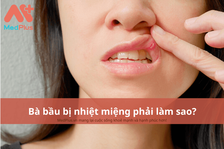 Bà bầu bị nhiệt miệng phải làm sao