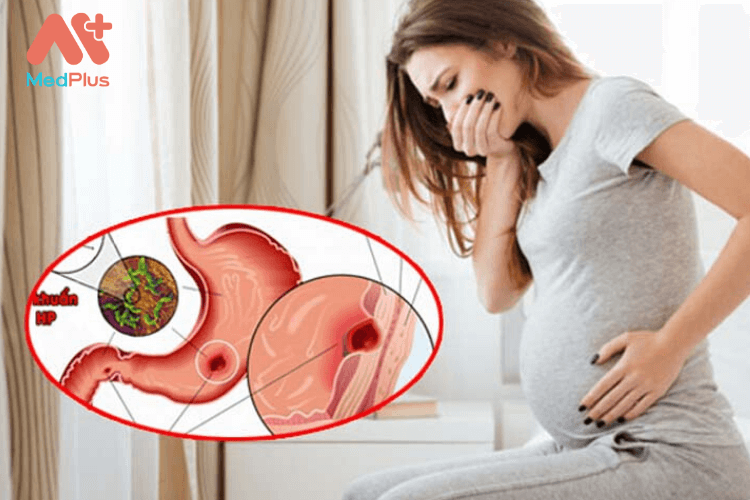 Đau dạ dày khi mang thai