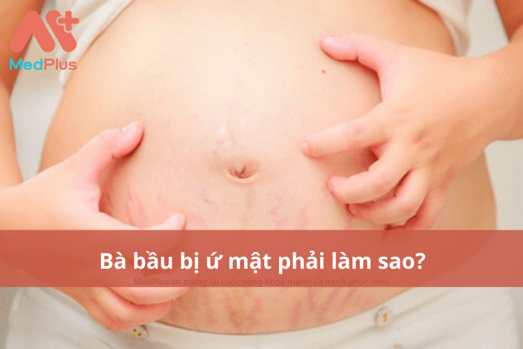 Bà bầu bị ứ mật phải làm thế nào?