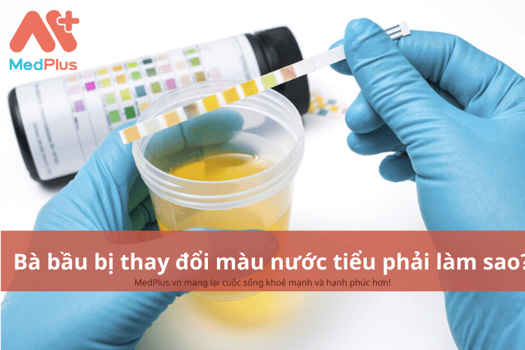Bà bầu bị thay đổi màu nước tiểu phải làm gì?