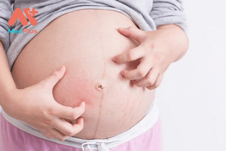 Bị dị ứng thời tiết khi mang thai có ảnh hưởng đến thai nhi không