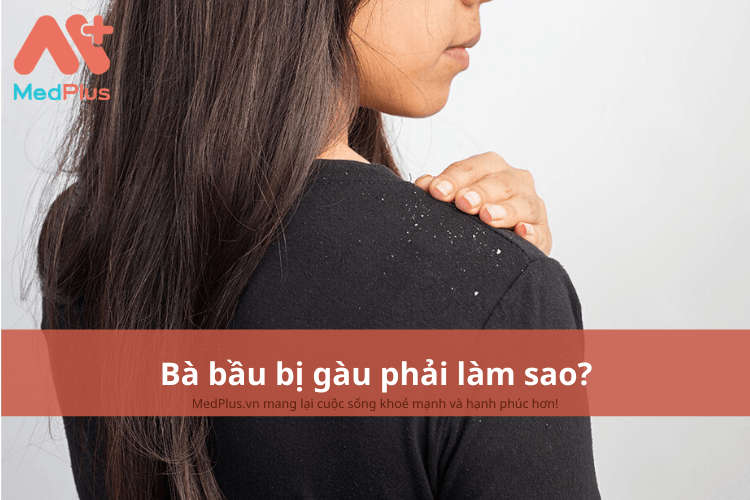 Bà bầu bị gàu phải làm sao?