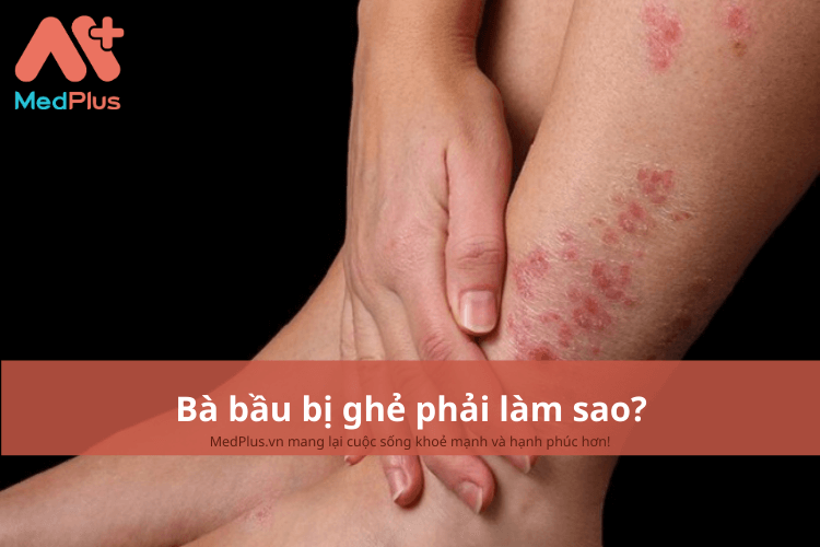 Những biện pháp chăm sóc da hiệu quả khi bầu bị ghẻ nước là gì?
