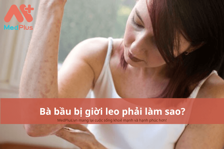 Những nghiên cứu và bằng chứng khoa học về ảnh hưởng của bệnh giời leo đến thai nhi? 
