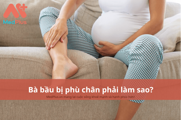 bà bầu bị phù chân phải làm sao?