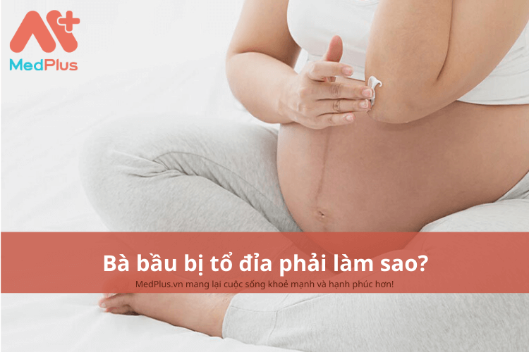 Bà bầu bị tổ đỉa phải làm sao