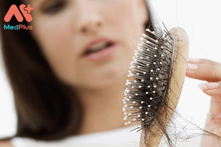 Cách trị rụng tóc cho phụ nữ mang thai