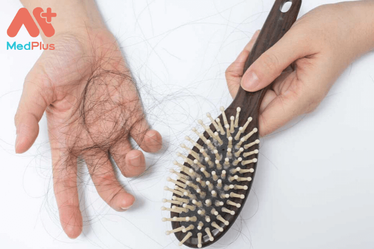 Những vấn đề về tóc thương gặp khi mang thai