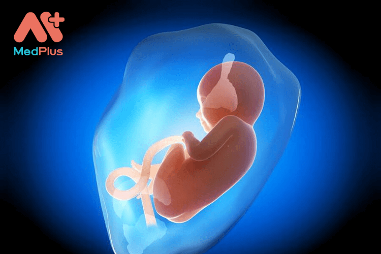 Thiếu nước ối có ảnh hưởng đến thai nhi không?