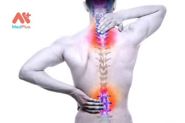 Đau thắt lưng ảnh hưởng đến hoạt động hằng ngày