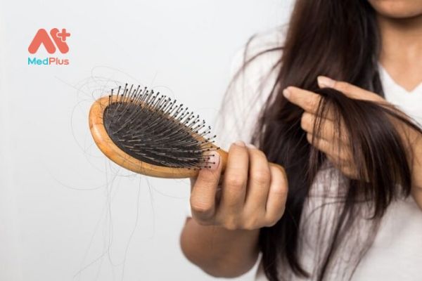 Rụng tóc nhiều dễ dẫn đến thưa tóc và hói đầu
