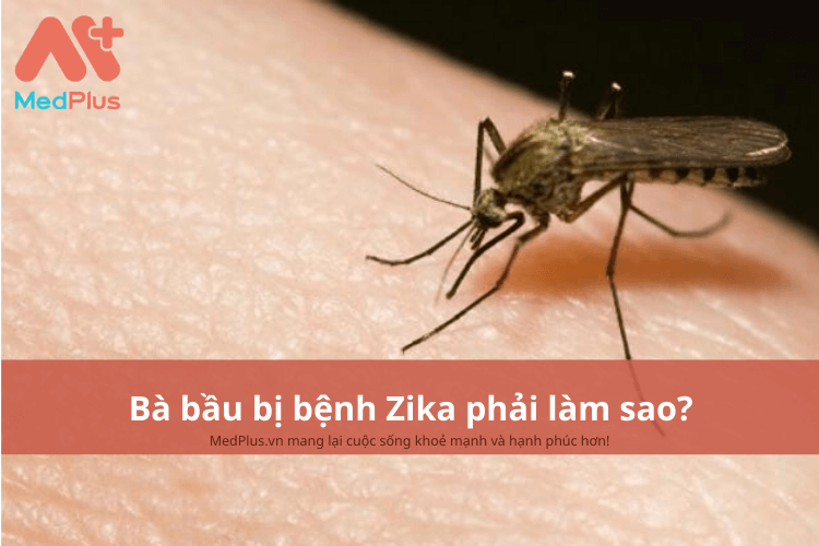 Bà bầu bị bệnh Zika phải làm sao?