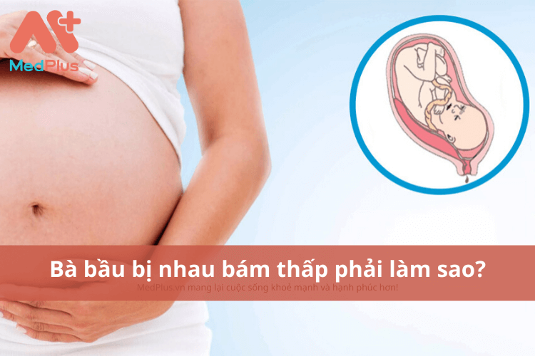 bà bầu bị nhau bám thấp phải làm sao?