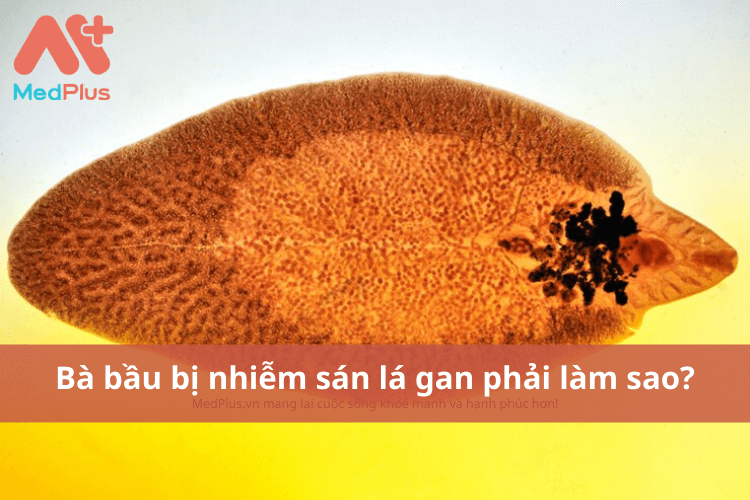 bà bầu bị nhiễm sán lá gan phải làm sao?