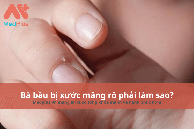 Bà bầu bị xước măng rô phải làm sao