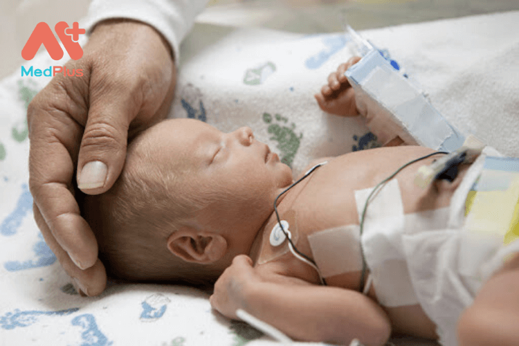 Biểu hiện của trẻ sơ sinh bị còi xương