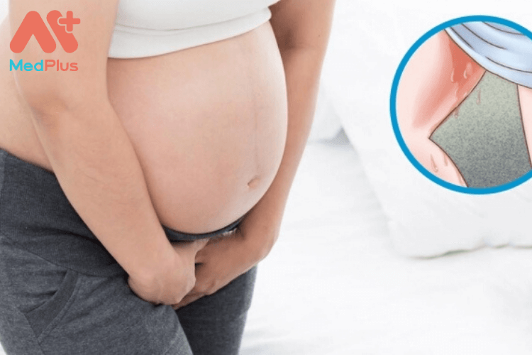 Nấm vùng kín khi mang thai