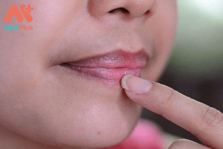 Thâm môi khi mang thai