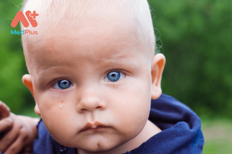 Trẻ bị chảy nước mắt sống có sao không?