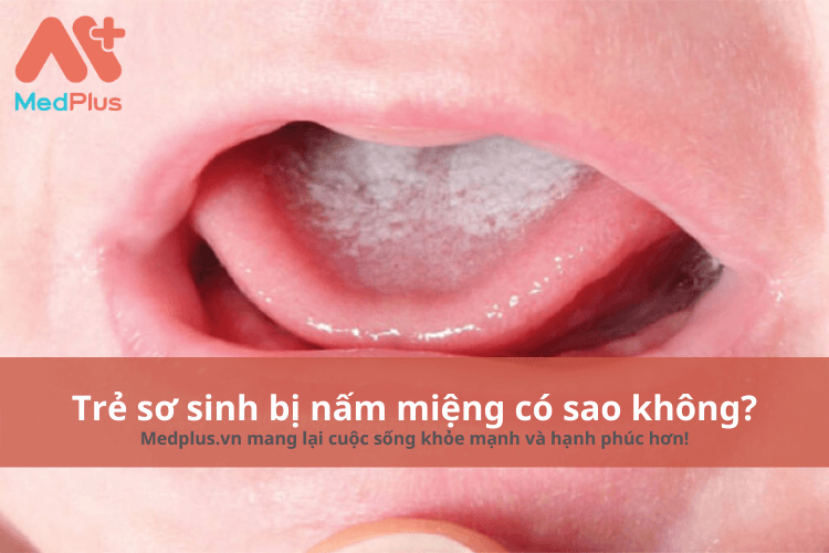 Trẻ sơ sinh bị nấm miệng có sao không