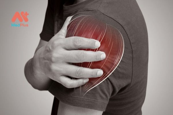 TOP 4+ thuốc bổ cơ tốt được tin tưởng sử dụng 2020 127 Làm sao để bồi bổ cơ?