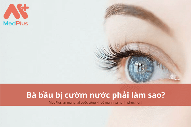Bà bầu bị cườm nước phải làm sao?