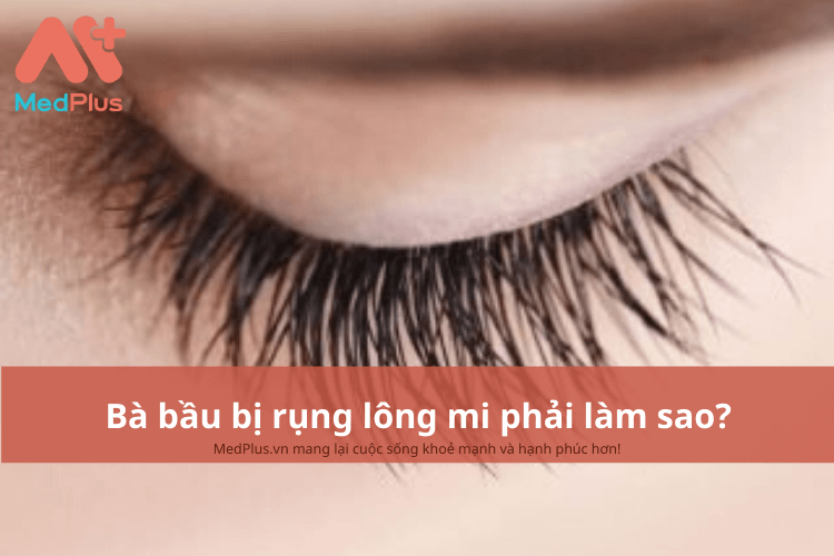 Bà bầu bị rụng lông mi phải làm sao?