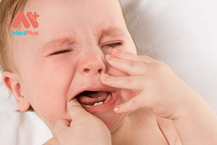 Trẻ bị viêm tủy răng là gì?