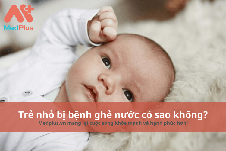 Trẻ nhỏ bị ghẻ nước có sao không