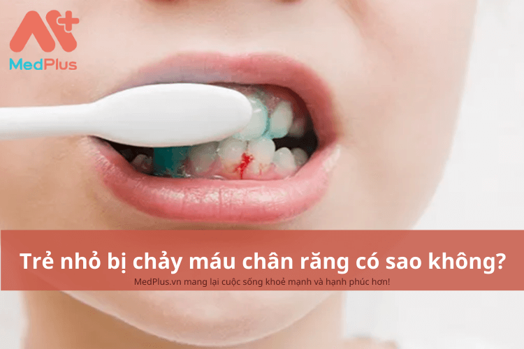 trẻ bị chảy máu chân răng có sao không?