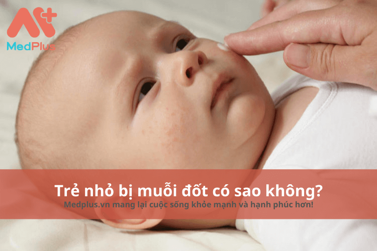 Trẻ nhỏ bị muỗi đốt có sao không? – Những điều bố mẹ cần biết 139 Trẻ sơ sinh bị muỗi đốt có sao không