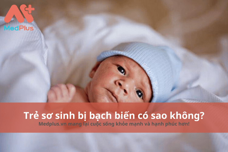 Trẻ sơ sinh bị bách biến có sao không