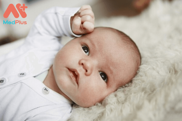 Trẻ sơ sinh bị bạch biến phải làm sao