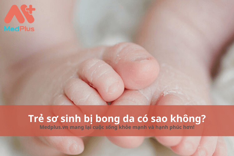 Trẻ sơ sinh bị bong da có sao không