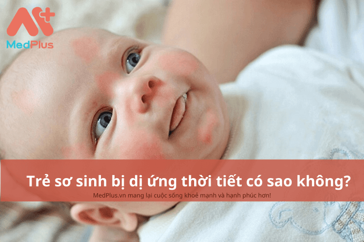 Trẻ sơ sinh bị dị ứng thời tiết có sao không?